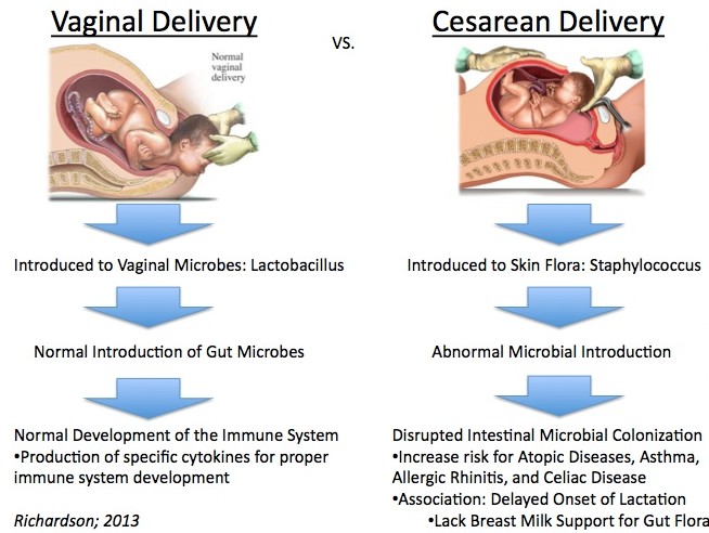 Why you should think twice about a C section - Functional Holistic ...